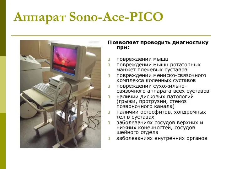 Аппарат Sono-Асе-PICO Позволяет проводить диагностику при: повреждении мышц повреждении мышц ротаторных