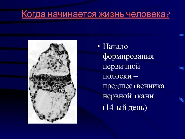 Когда начинается жизнь человека? Начало формирования первичной полоски – предшественника нервной ткани (14-ый день)