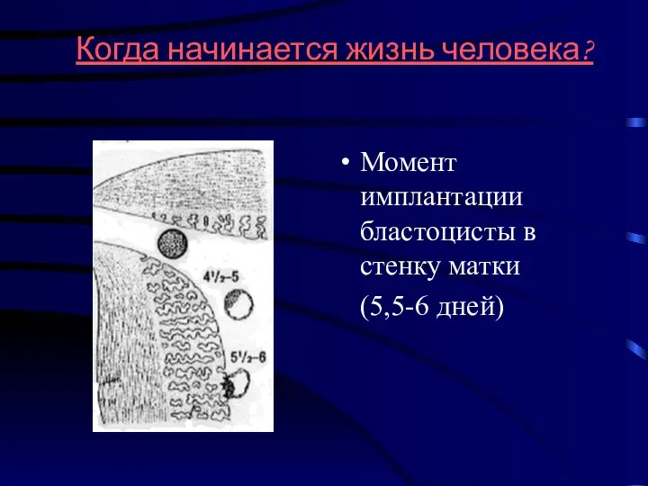 Когда начинается жизнь человека? Момент имплантации бластоцисты в стенку матки (5,5-6 дней)