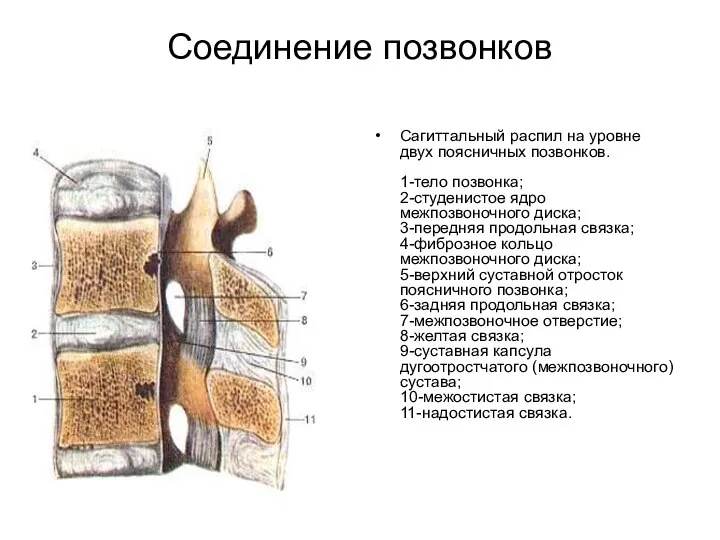 Соединение позвонков Сагиттальный распил на уровне двух поясничных позвонков. 1-тело позвонка;