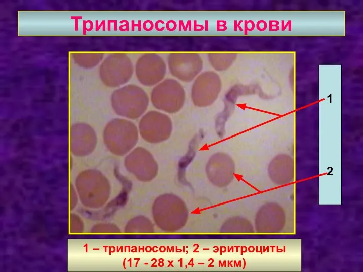 Трипаносомы в крови 1 2 1 – трипаносомы; 2 – эритроциты