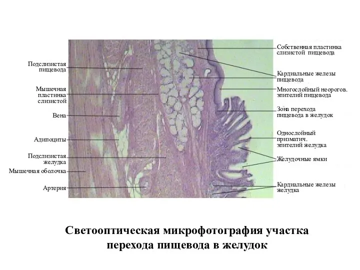 Светооптическая микрофотография участка перехода пищевода в желудок Артерия Мышечная пластинка слизистой