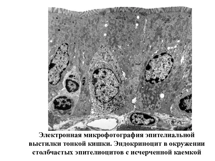 Электронная микрофотография эпителиальной выстилки тонкой кишки. Эндокриноцит в окружении столбчастых эпителиоцитов с исчерченной каемкой