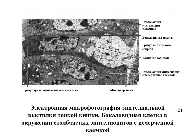 Электронная микрофотография эпителиальной выстилки тонкой кишки. Бокаловидная клетка в окружении столбчастых