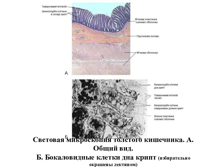 Световая микроскопия толстого кишечника. А. Общий вид. Б. Бокаловидные клетки дна крипт (избирательно окрашены лектином)