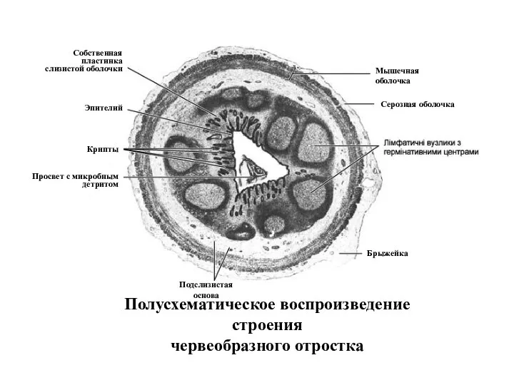 Полусхематическое воспроизведение строения червеобразного отростка Мышечная оболочка Собственная пластинка слизистой оболочки