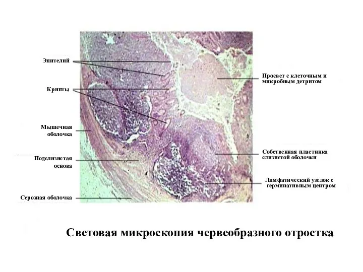 Световая микроскопия червеобразного отростка Эпителий Мышечная оболочка Серозная оболочка Подслизистая основа