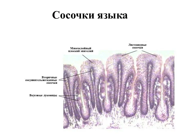 Сосочки языка Листовидные сосочки Многослойный плоский эпителий Вторичные соединительнотканные сосочки Вкусовые луковицы