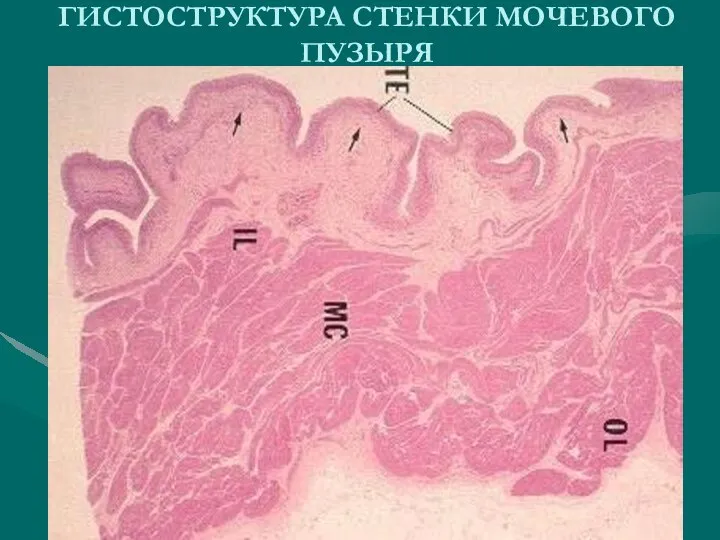 ГИСТОСТРУКТУРА СТЕНКИ МОЧЕВОГО ПУЗЫРЯ