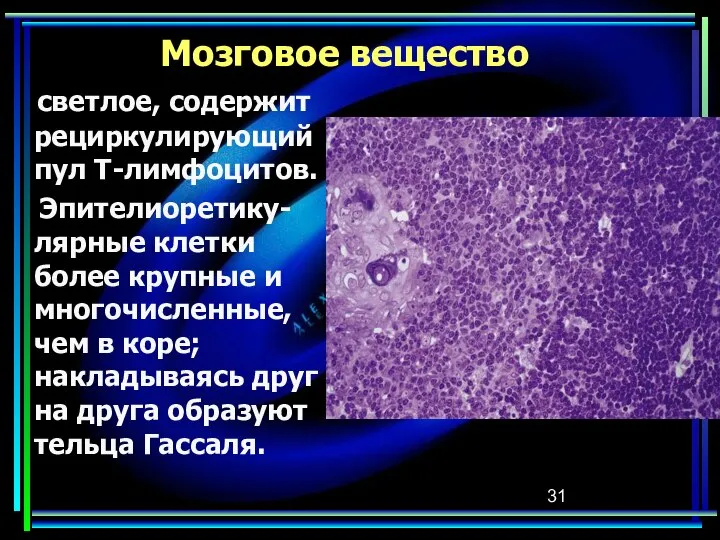 Мозговое вещество светлое, содержит рециркулирующий пул Т-лимфоцитов. Эпителиоретику-лярные клетки более крупные