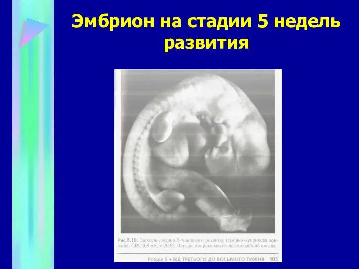 Эмбрион на стадии 5 недель развития