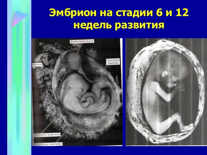 Эмбрион на стадии 6 и 12 недель развития