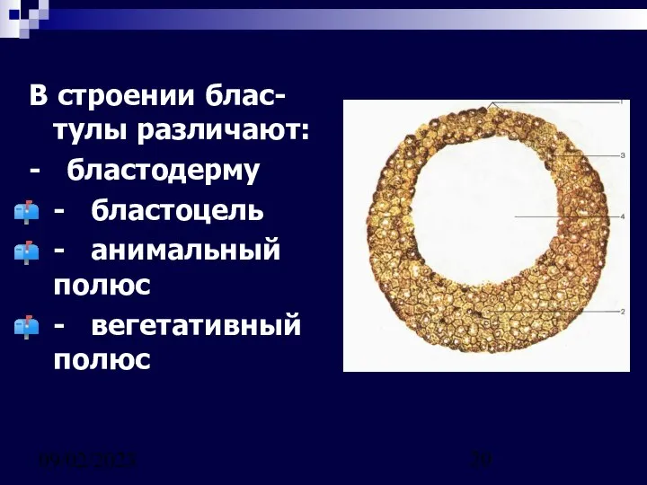 09/02/2023 В строении блас-тулы различают: - бластодерму - бластоцель - анимальный полюс - вегетативный полюс