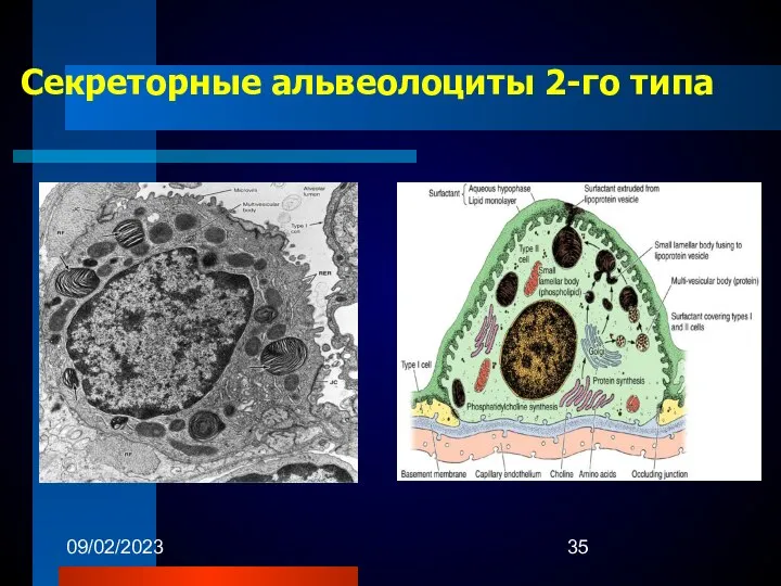 09/02/2023 Секреторные альвеолоциты 2-го типа