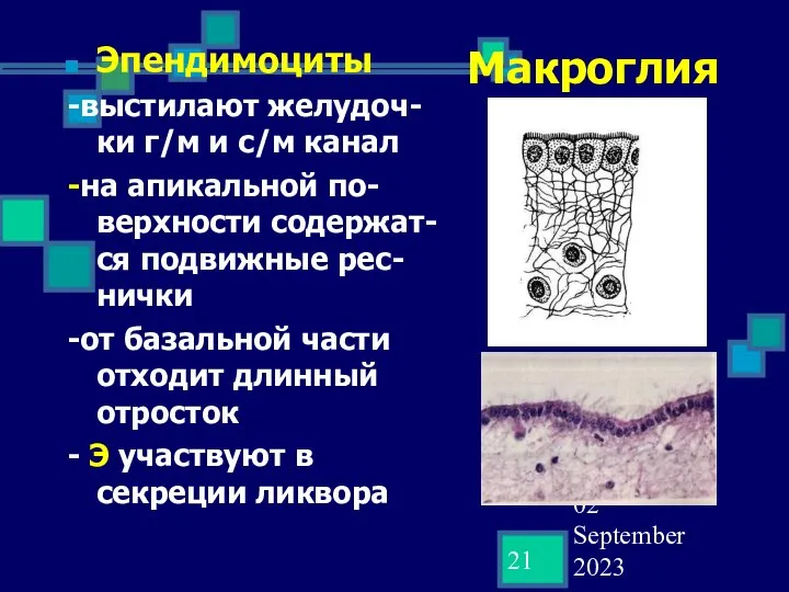 02 September 2023 Макроглия Эпендимоциты -выстилают желудоч-ки г/м и с/м канал