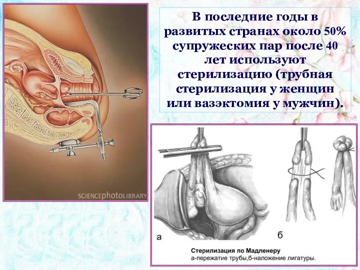 В последние годы в развитых странах около 50% супружеских пар после