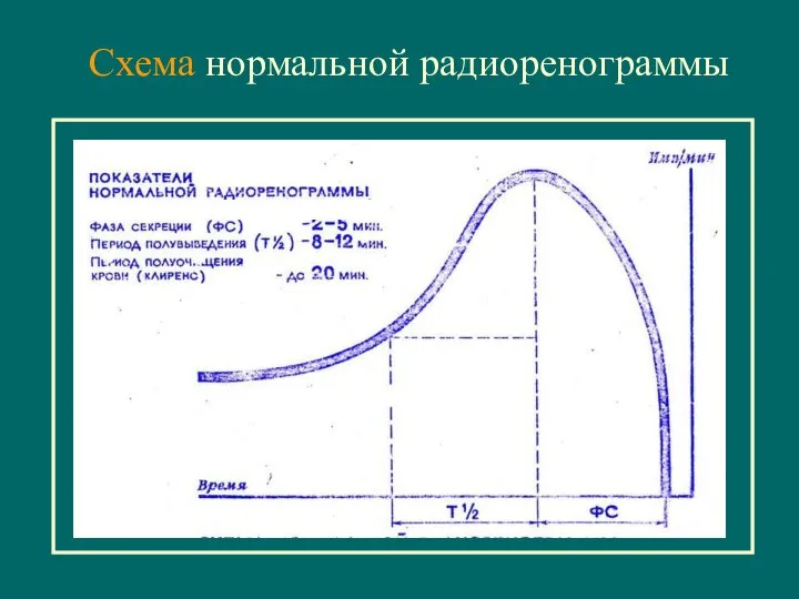 Cхема нормальной радиоренограммы