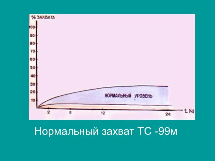 Нормальный захват ТС -99м