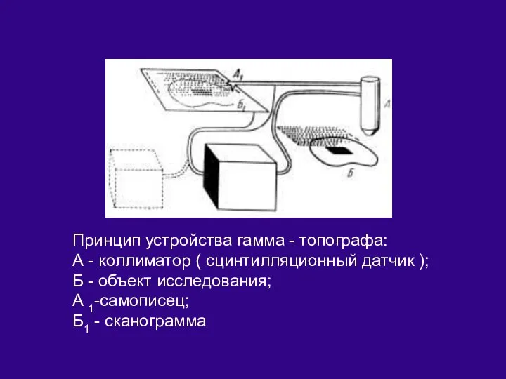 Принцип устройства гамма - топографа: А - коллиматор ( сцинтилляционный датчик