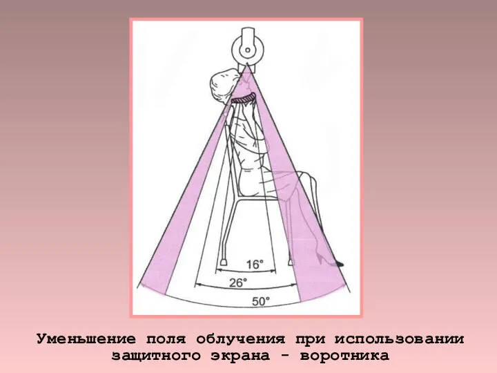 Уменьшение поля облучения при использовании защитного экрана - воротника