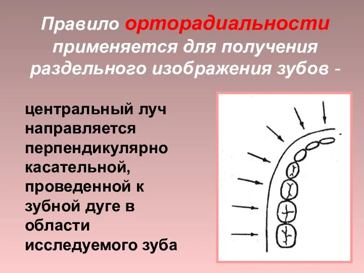 Правило орторадиальности применяется для получения раздельного изображения зубов - центральный луч