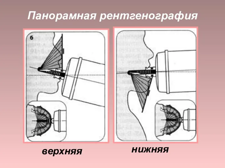 Панорамная рентгенография