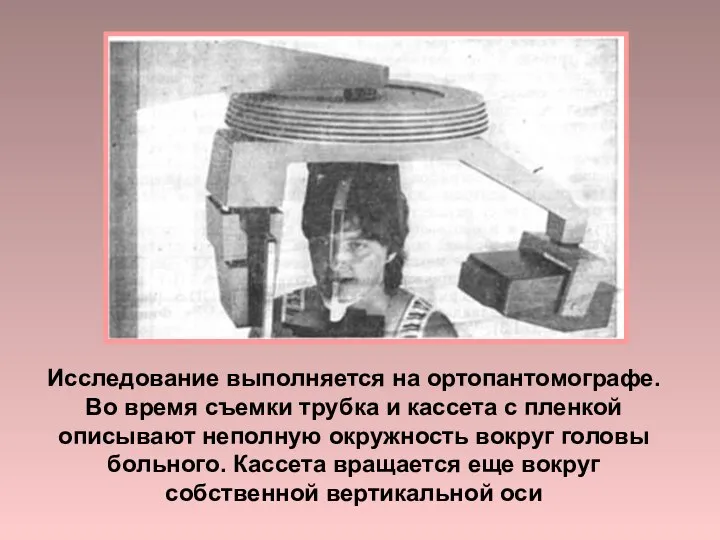 Исследование выполняется на ортопантомографе. Во время съемки трубка и кассета с