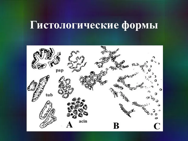 Гистологические формы