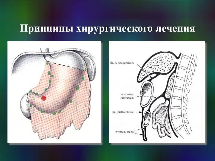 Принципы хирургического лечения