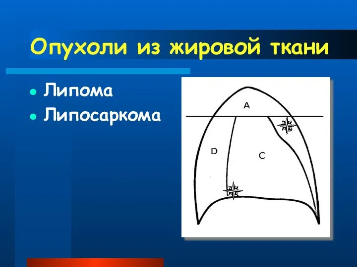 Опухоли из жировой ткани Липома Липосаркома