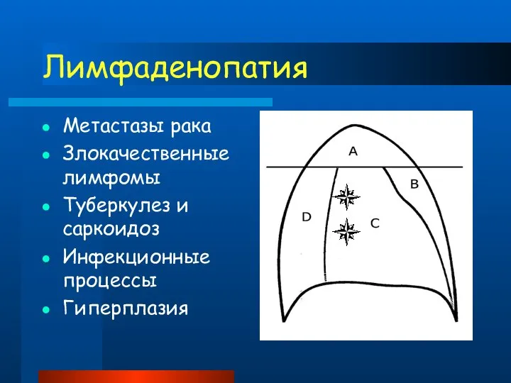 Лимфаденопатия Метастазы рака Злокачественные лимфомы Туберкулез и саркоидоз Инфекционные процессы Гиперплазия