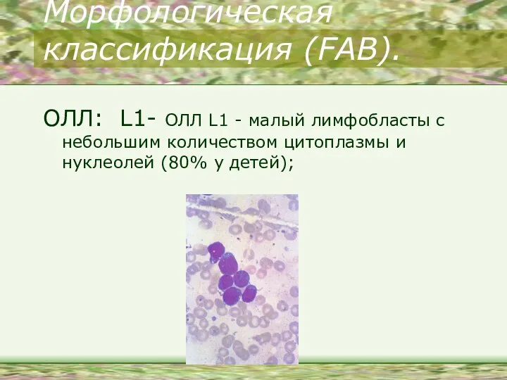 Морфологическая классификация (FAB). ОЛЛ: L1- ОЛЛ L1 - малый лимфобласты с