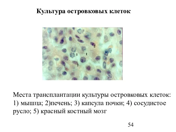 Культура островковых клеток Места трансплантации культуры островковых клеток: 1) мышца; 2)печень;