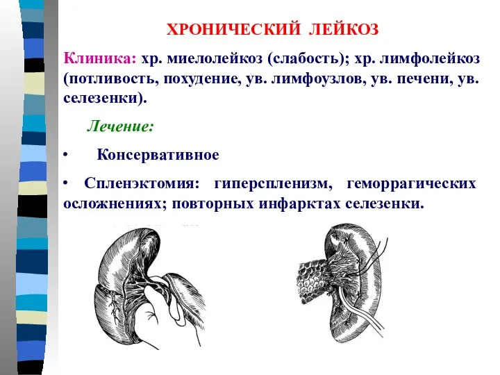 ХРОНИЧЕСКИЙ ЛЕЙКОЗ Клиника: хр. миелолейкоз (слабость); хр. лимфолейкоз (потливость, похудение, ув.