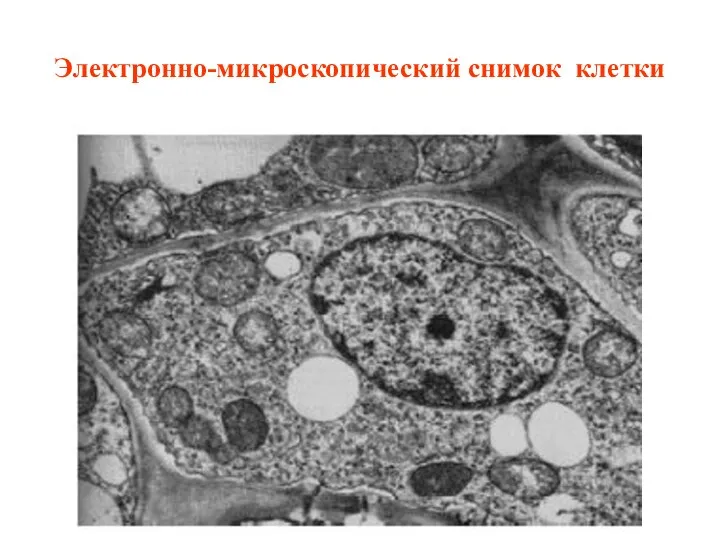 Электронно-микроскопический снимок клетки