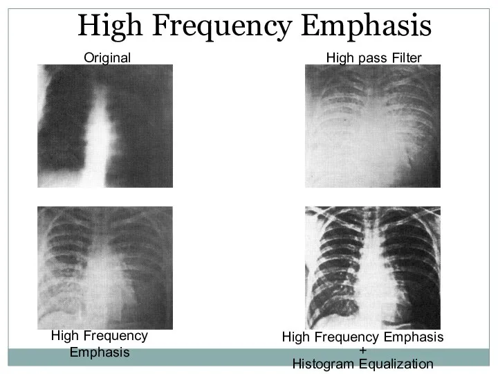 Original High Frequency Emphasis
