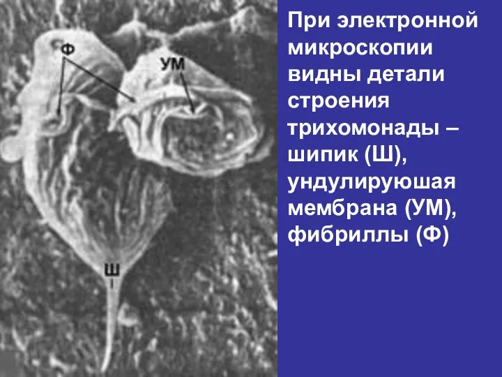 При электронной микроскопии видны детали строения трихомонады – шипик (Ш), ундулируюшая мембрана (УМ), фибриллы (Ф)