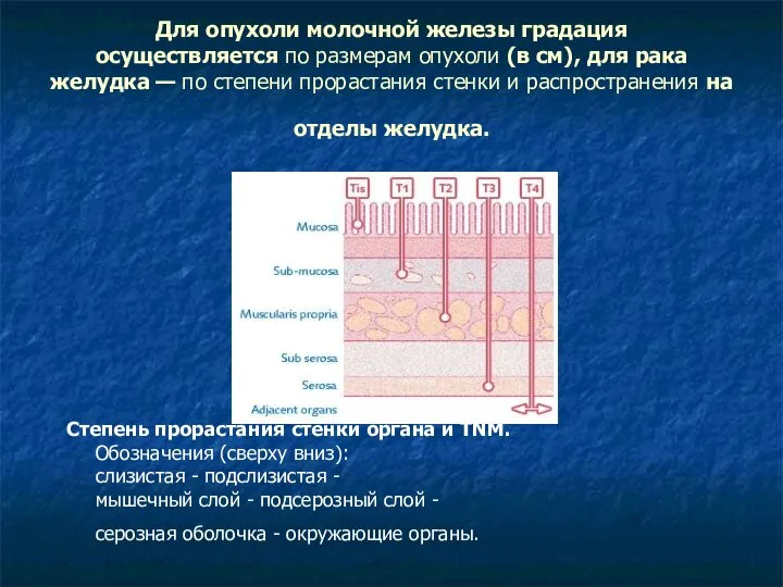 Для опухоли молочной железы градация осуществляется по размерам опухоли (в см),