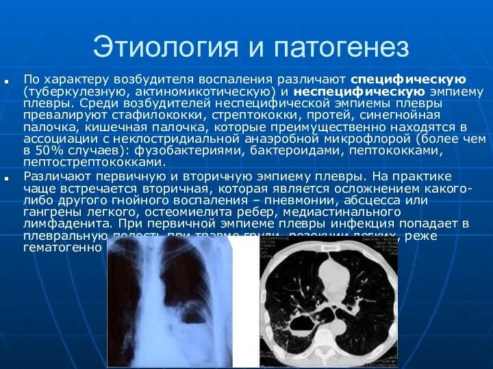 Этиология и патогенез По характеру возбудителя воспаления различают специфическую (туберкулезную, актиномикотическую)