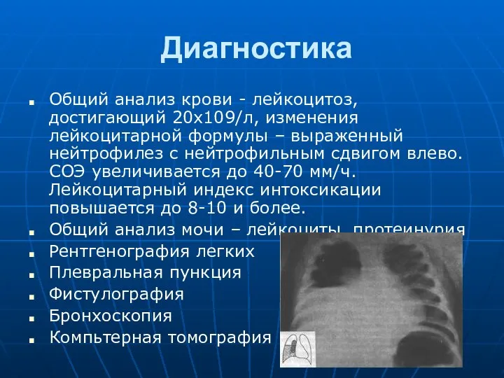 Диагностика Общий анализ крови - лейкоцитоз, достигающий 20х109/л, изменения лейкоцитарной формулы