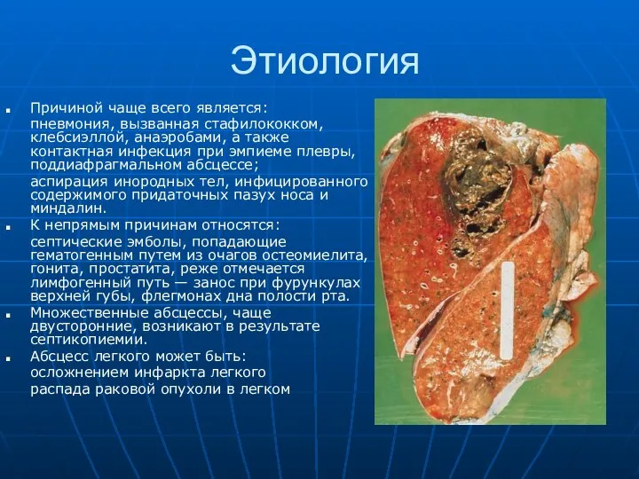 Этиология Причиной чаще всего является: пневмония, вызванная стафилококком, клебсиэллой, анаэробами, а