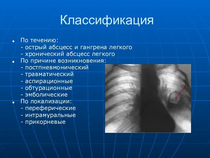 Классификация По течению: - острый абсцесс и гангрена легкого - хронический