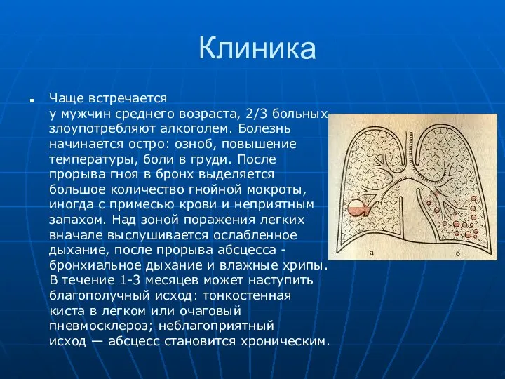 Клиника Чаще встречается у мужчин среднего возраста, 2/3 больных злоупотребляют алкоголем.