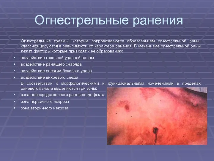 Огнестрельные ранения Огнестрельные травмы, которые сопровождаются образованием огнестрельной раны, классифицируются в