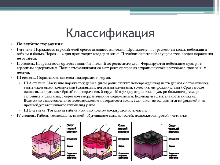 Классификация По глубине поражения I степень. Поражается верхний слой ороговевающего эпителия.