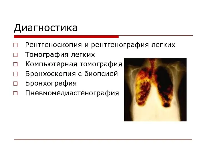 Диагностика Рентгеноскопия и рентгенография легких Томография легких Компьютерная томография Бронхоскопия с биопсией Бронхография Пневмомедиастенография