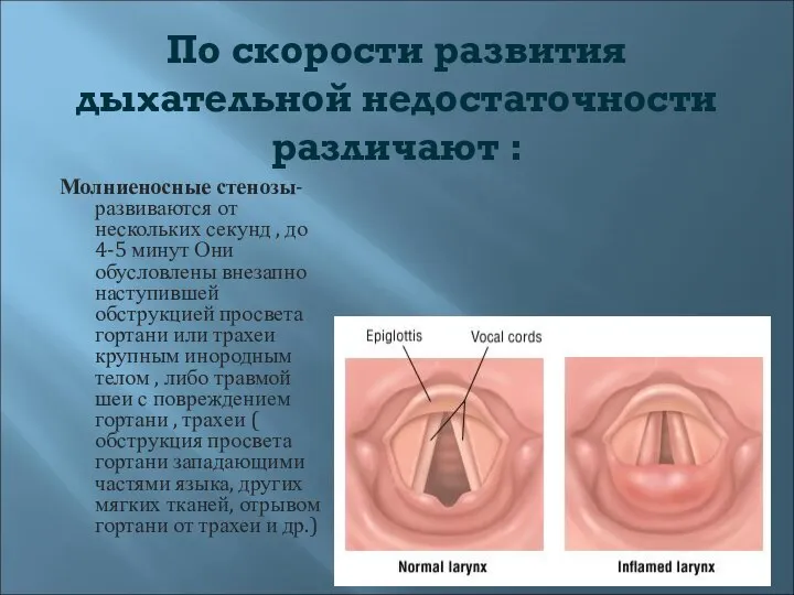 По скорости развития дыхательной недостаточности различают : Молниеносные стенозы- развиваются от