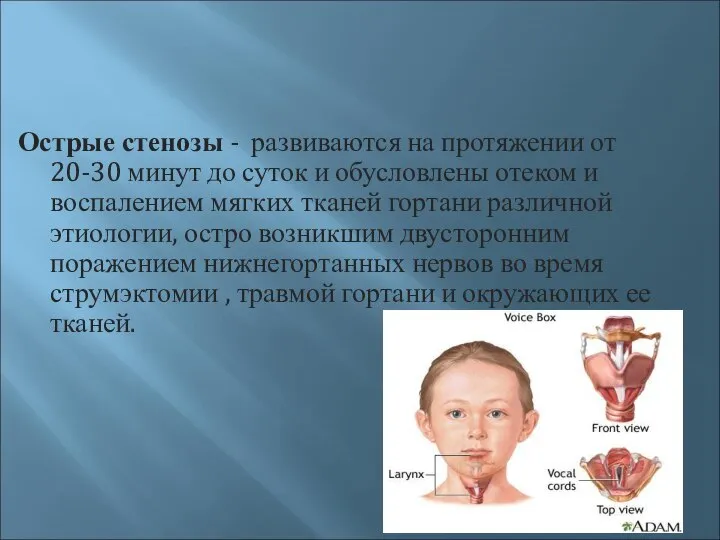 Острые стенозы - развиваются на протяжении от 20-30 минут до суток