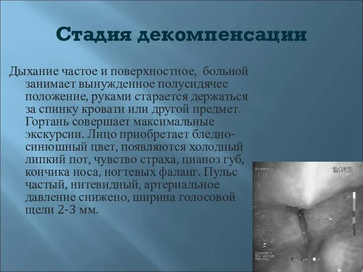 Стадия декомпенсации Дыхание частое и поверхностное, больной занимает вынужденное полусидячее положение,