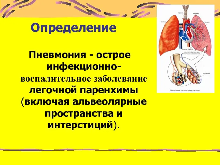 Определение Пневмония - острое инфекционно-воспалительное заболевание легочной паренхимы (включая альвеолярные пространства и интерстиций).
